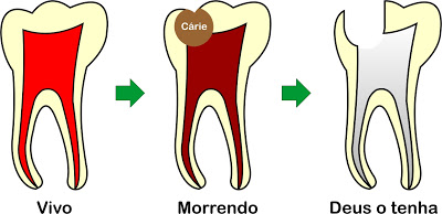 Tratamento de canal